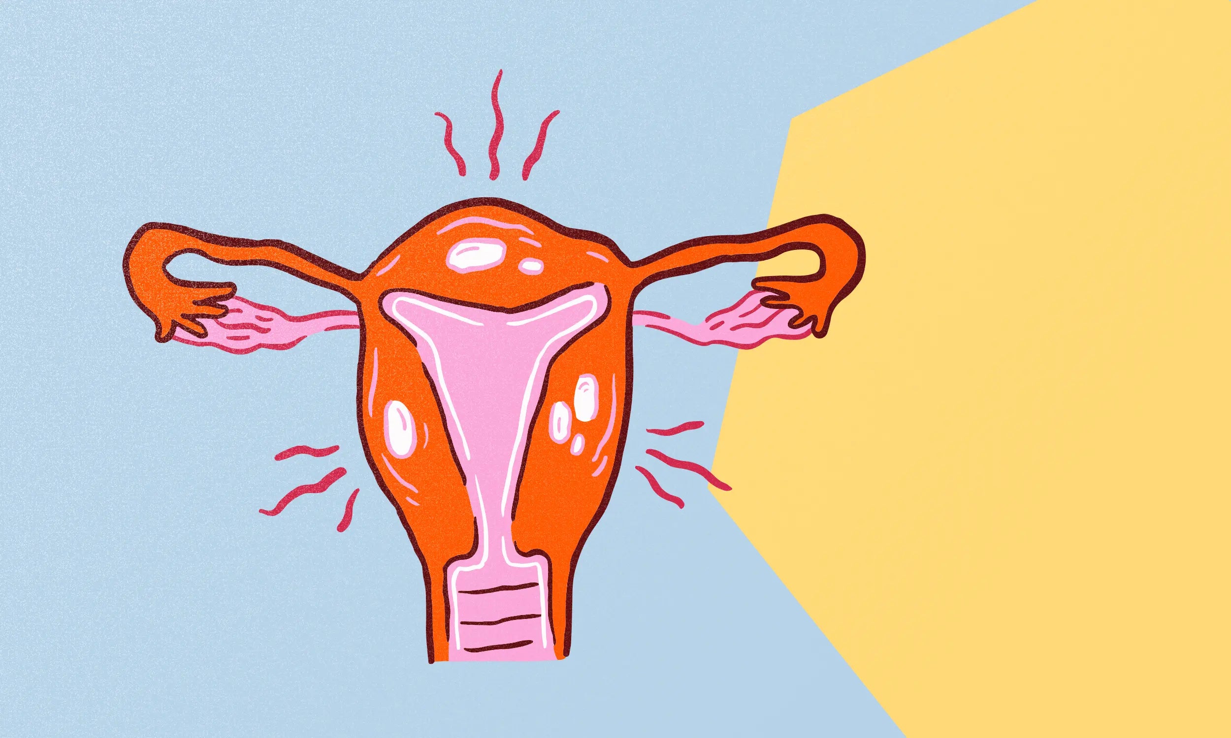Hvad er endometriose? Symptomer, smerter og hvorfor sygdommen stadig overses Flow Intimates